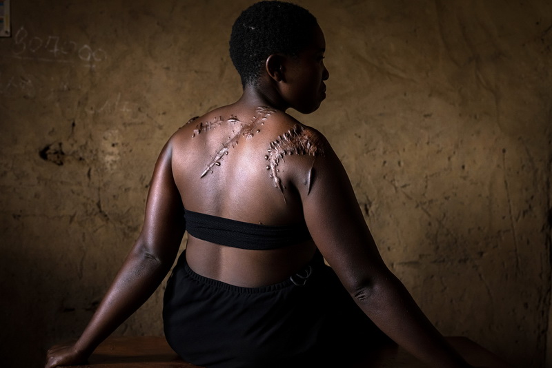 Brent Stirton la mostra “Virunga: 100 anni”.