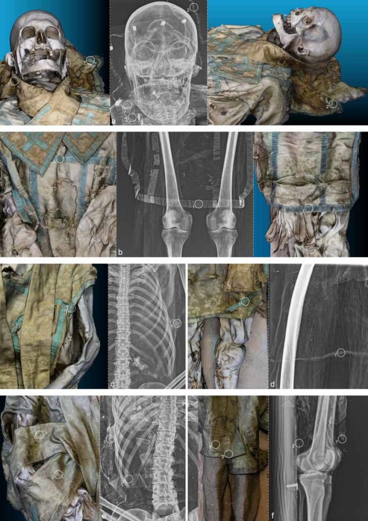 fotopuntoit_Under-the-Skin_X-ray-of-the-mummy_portrait-format_Omar-Larentis